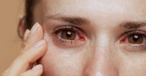 Why Your Eyes Feel Dry When the Heat Turns On: Fall and Winter Dry Eye Tips